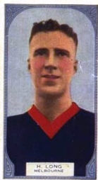 Harry Long   1933 Hoadleys